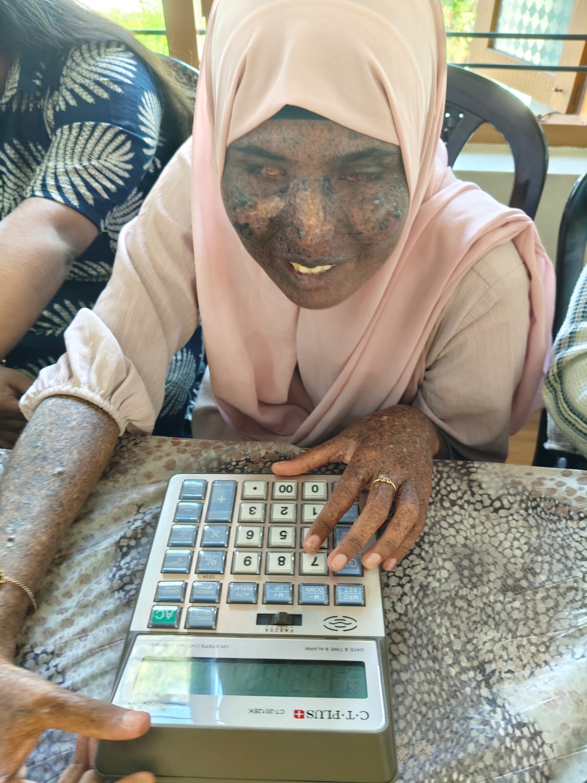 Exhibition of Assistive Gadgets photo 1